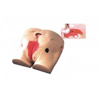 【益联医学】老年人褥疮（压疮）护理模型